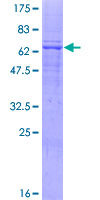 12.5% SDS-PAGE Stained with Coomassie Blue.